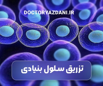 تزریق سلول بنیادی در کلینیک دکتر یزدانی